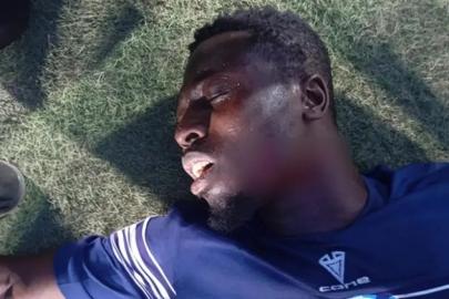 Korkunç Saldırı! Nijerya Ligi Maçında Futbolcuya Bıçaklı Saldırı